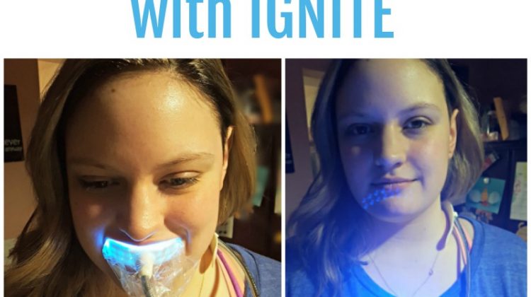 Have Whiter Teeth with IGNITE