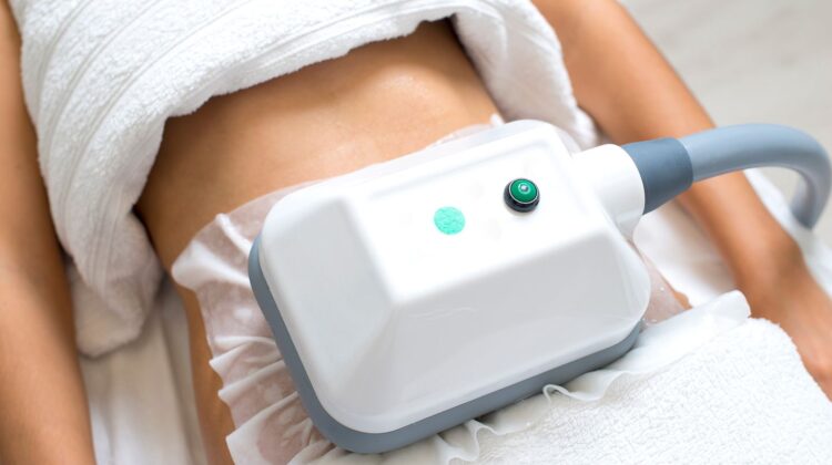 Coolsculpting
