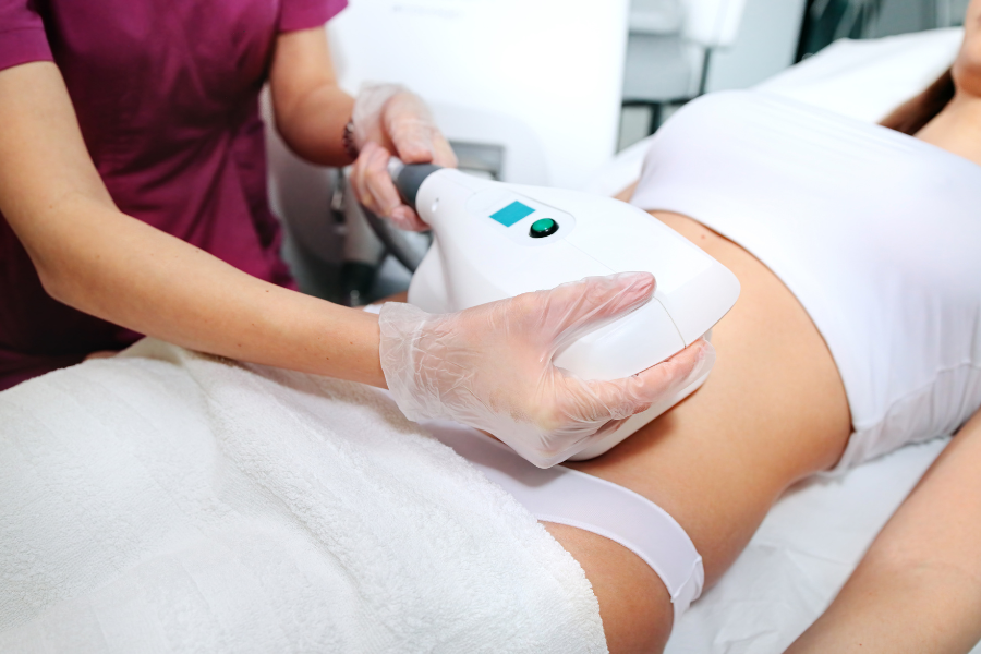 CoolSculpting