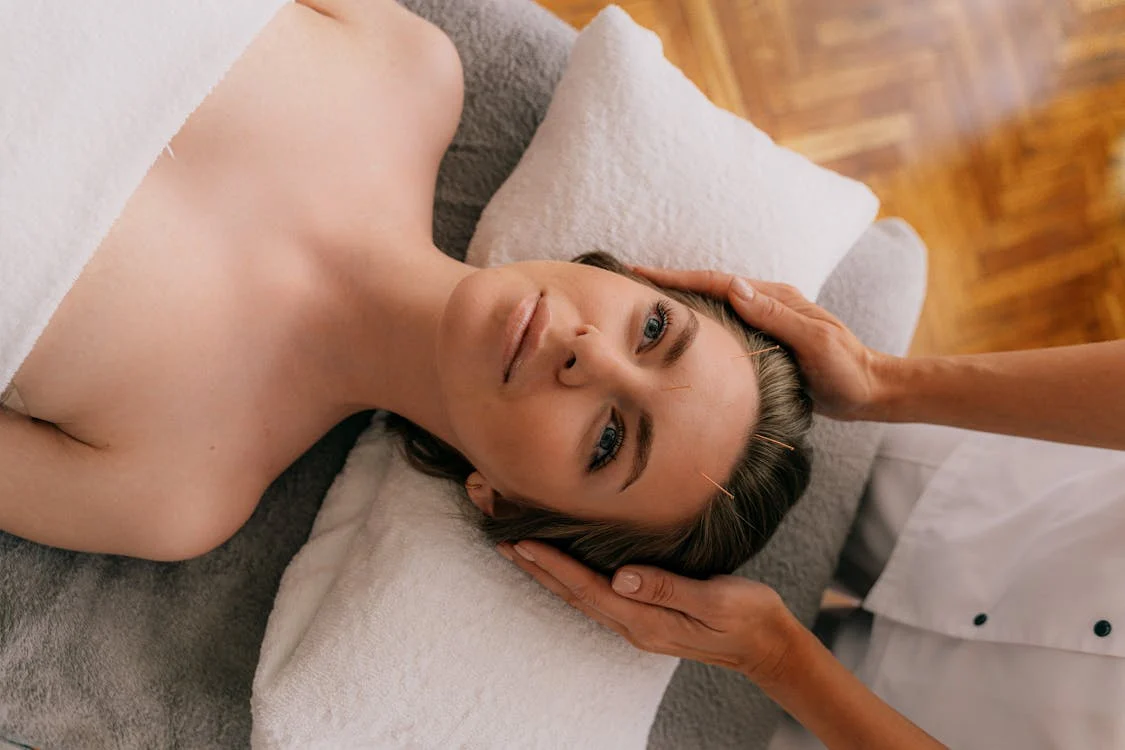 woman getting acupuncture