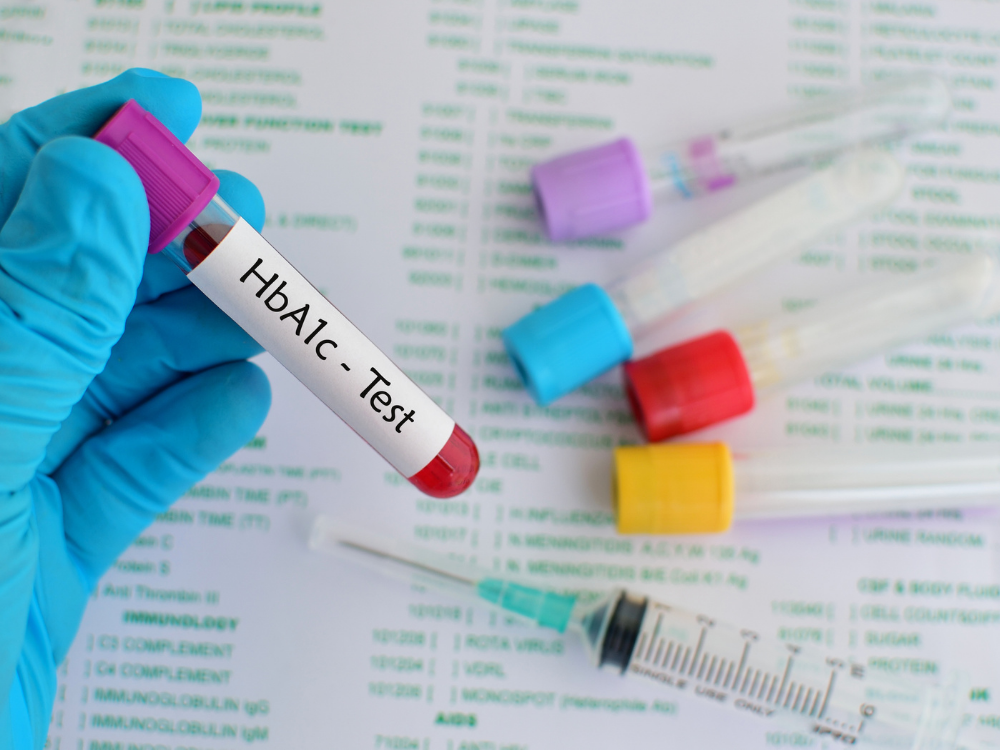 A1c test
