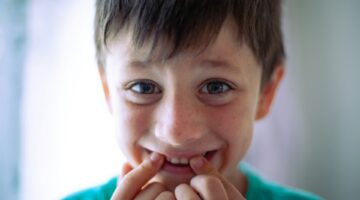 child's smile